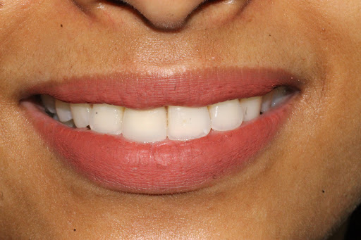 Photo from customer review