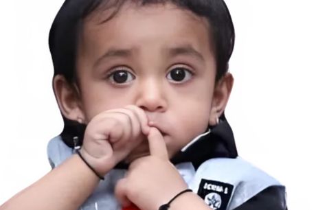 Habit Breaking Appliance