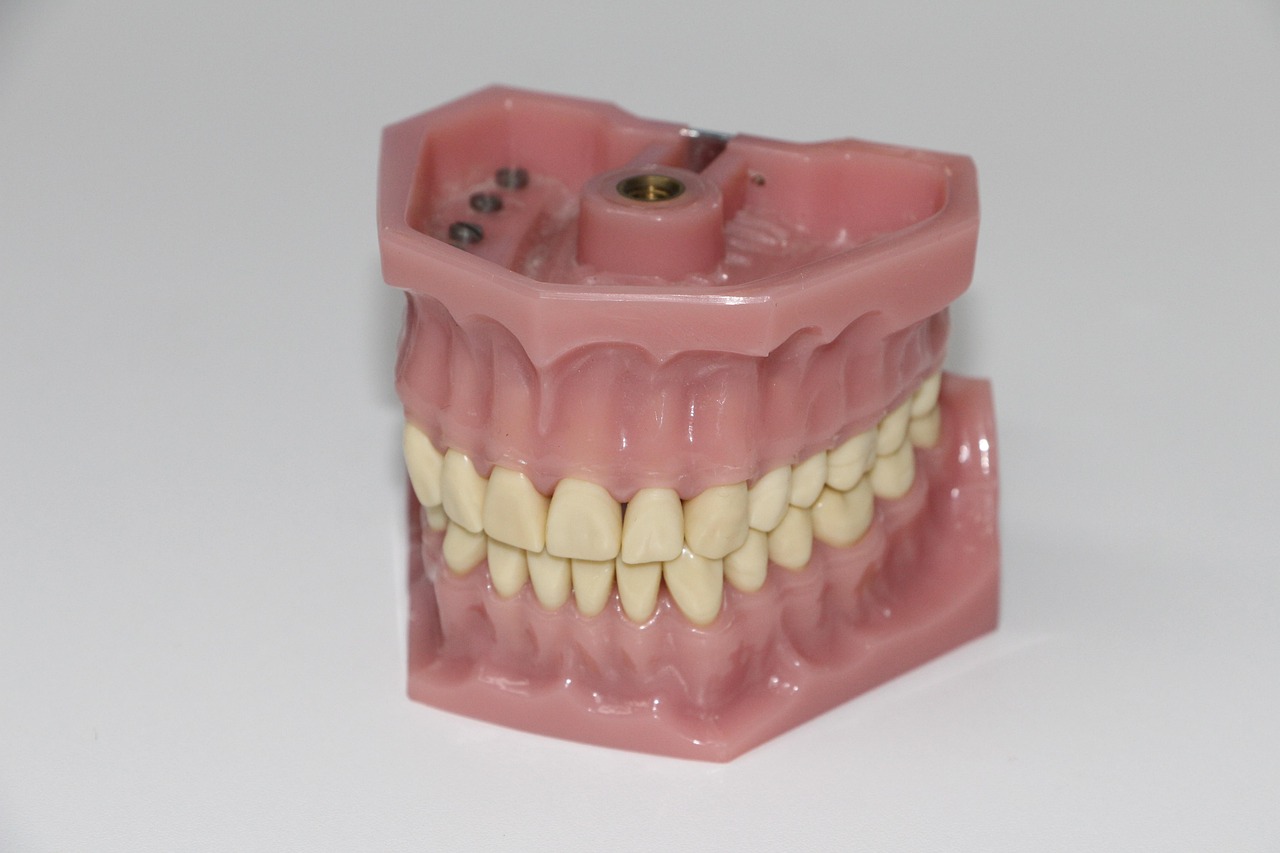dental prosthesis 1514697 1280 (2)